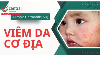 Viêm da cơ địa: nguyên nhân, cách điều trị, có lây không?