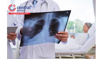 Viêm phổi bệnh viện: nguyên nhân, triệu chứng và cách điều trị