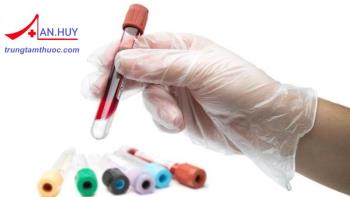 Ý nghĩa của các chỉ số trong phiếu xét nghiệm máu và bệnh liên quan