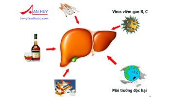 Nguyên nhân, cách phòng ngừa và chế độ chăm sóc bệnh nhân xơ gan