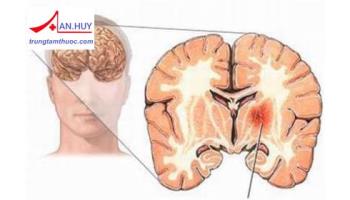 Quy trình chẩn đoán và điều trị chấn thương sọ não