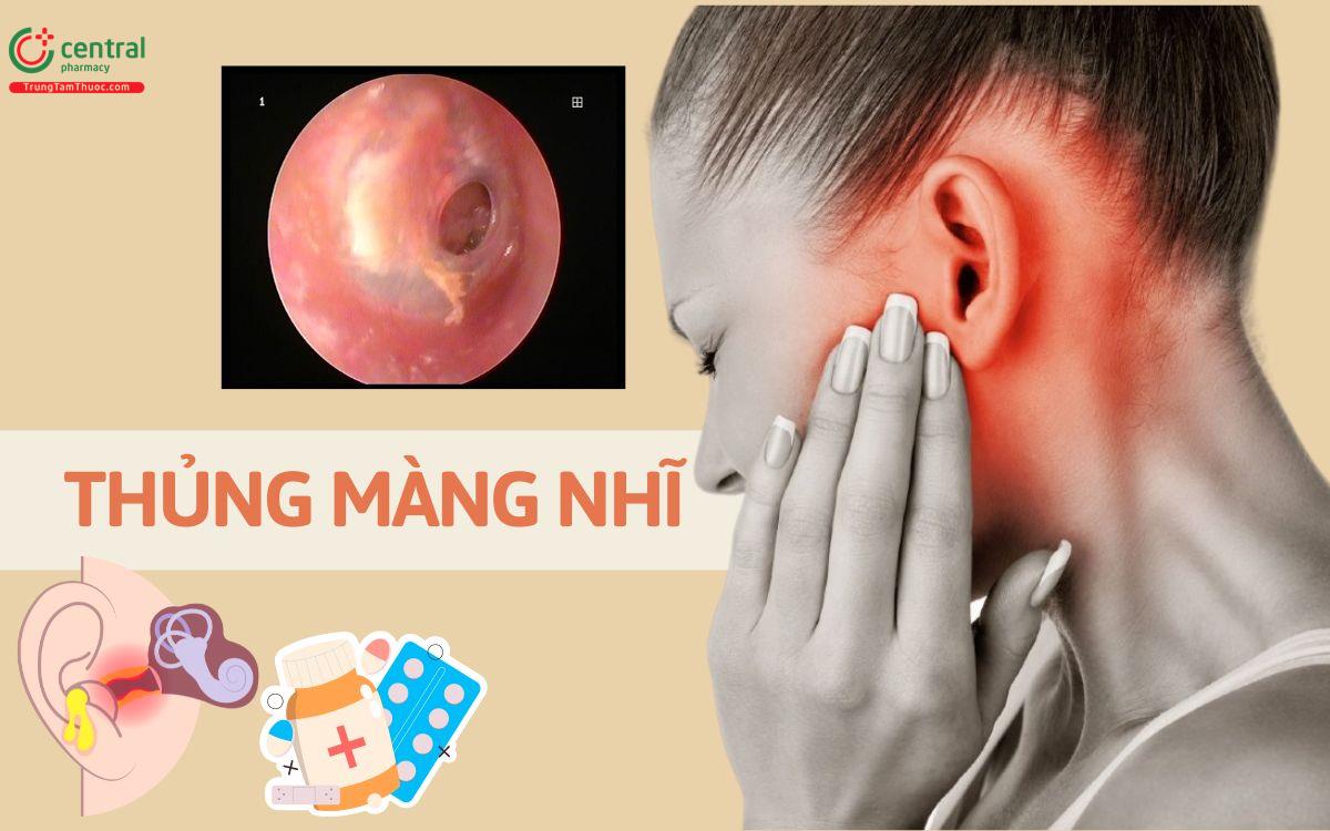 Thủng màng nhĩ có điếc không? Có tự liền được không? Dấu hiệu và cách chữa tại nhà