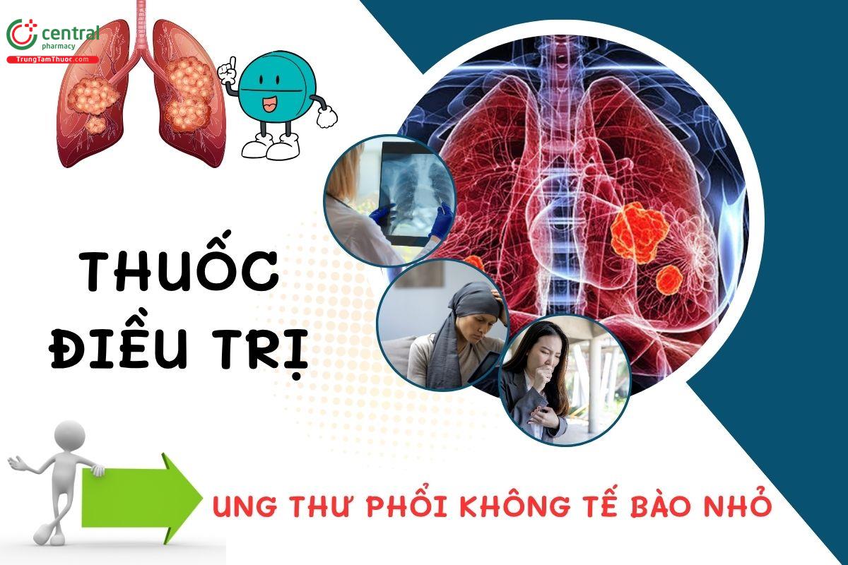 Phân loại thuốc điều trị ung thư phổi không tế bào nhỏ và phác đồ điều trị của Bộ Y tế