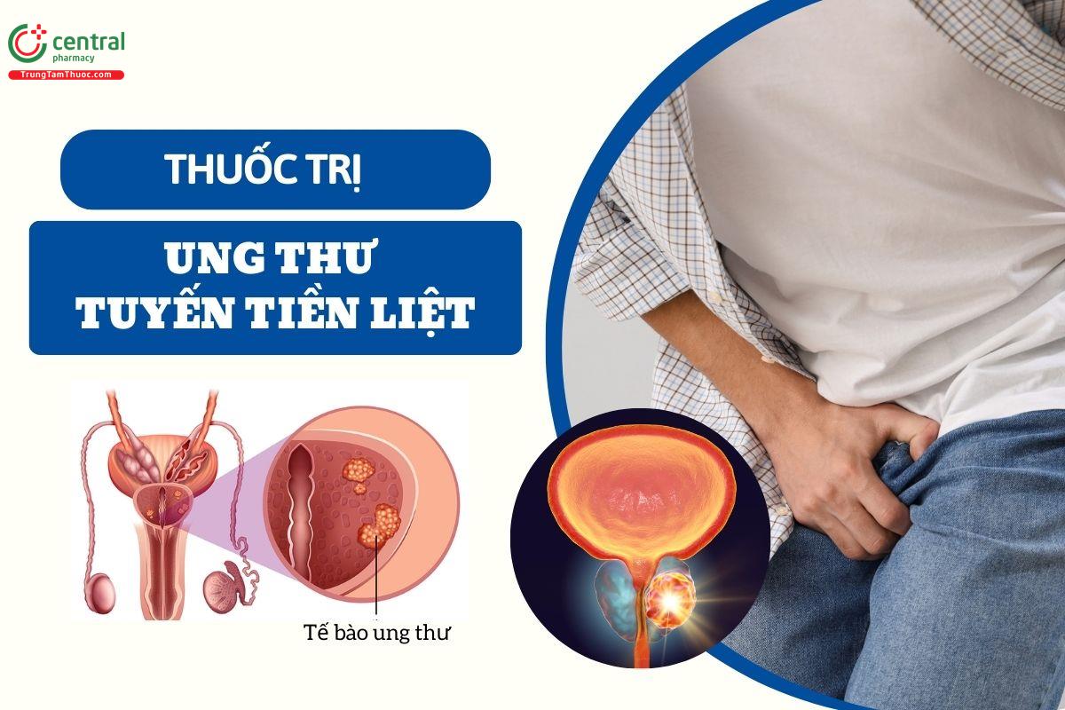 Phân loại thuốc điều trị ung thư tuyến tiền liệt theo phác đồ Bộ Y tế và ESMO