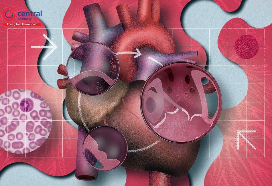 AHA: Các thuốc có thể gây ra hoặc làm trầm trọng thêm bệnh suy tim 