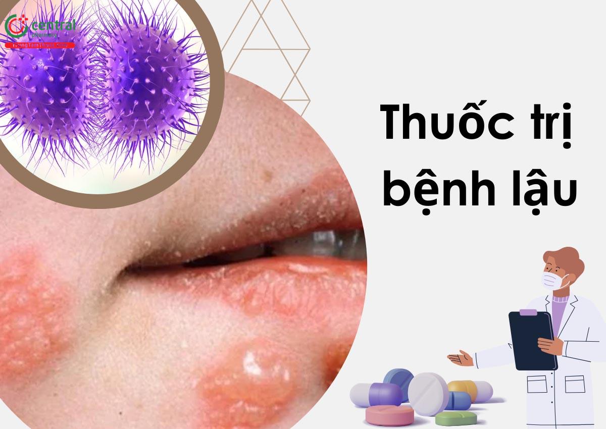 Phác Đồ Điều Trị Bệnh Lậu Của Bộ Y Tế: Hướng Dẫn Chi Tiết Từ A-Z