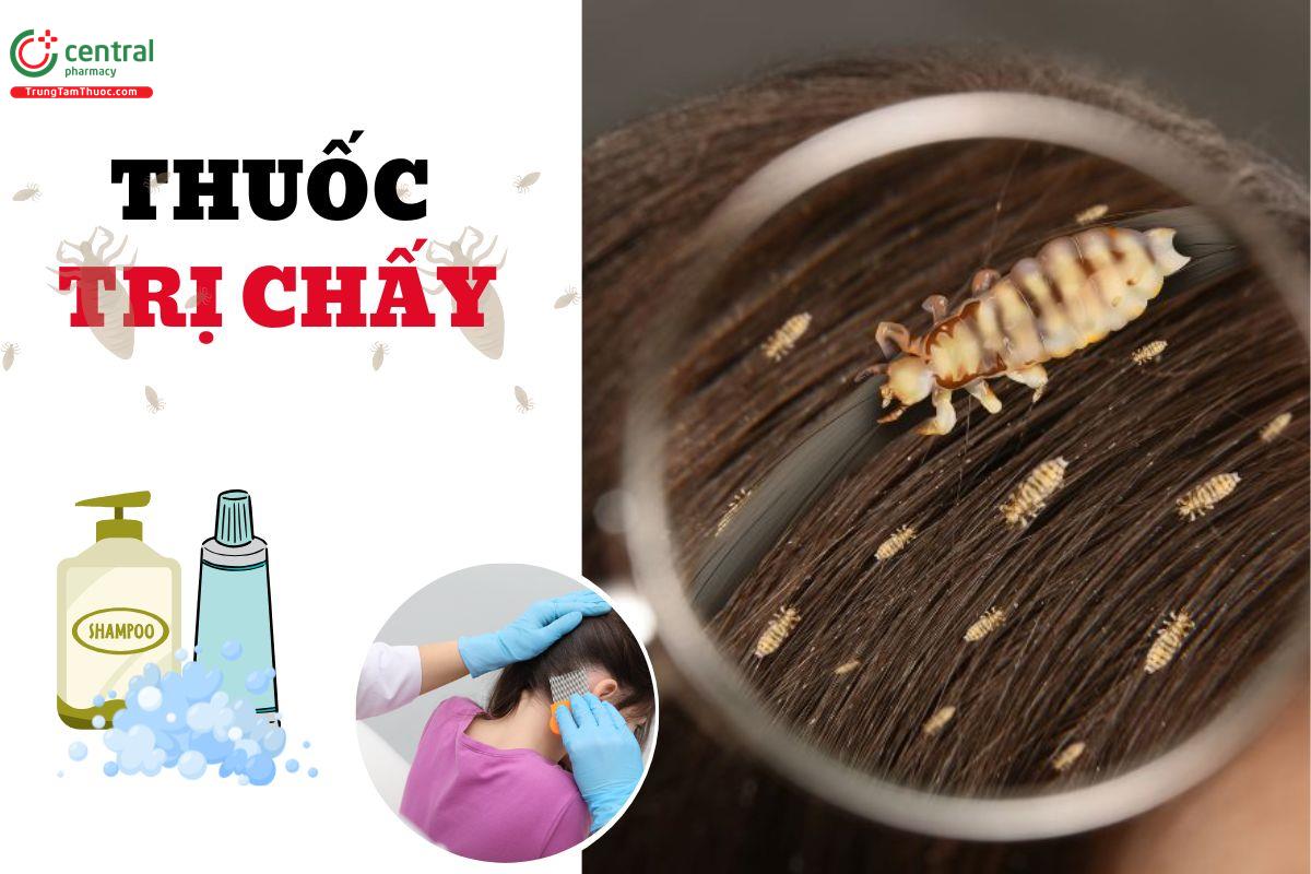 Thuốc trị chấy, diệt trứng chấy được các chuyên gia khuyên dùng