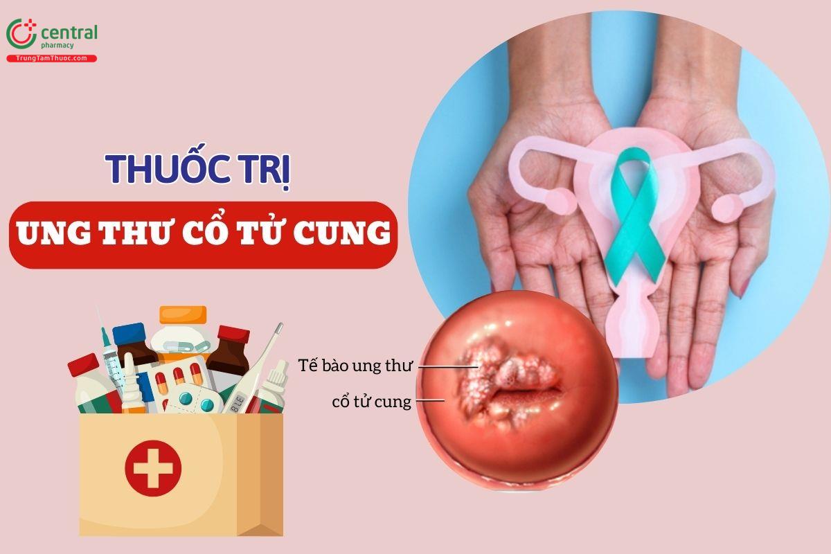 Phân loại thuốc điều trị ung thư cổ tử cung theo phác đồ của Bộ Y tế