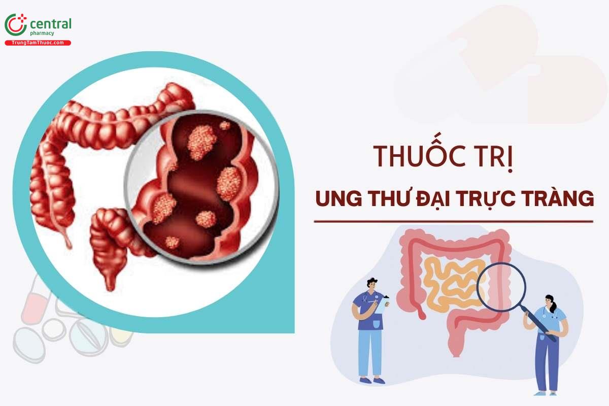 Phân loại thuốc điều trị ung thư đại trực tràng theo phác đồ Bộ Y tế và ESMO