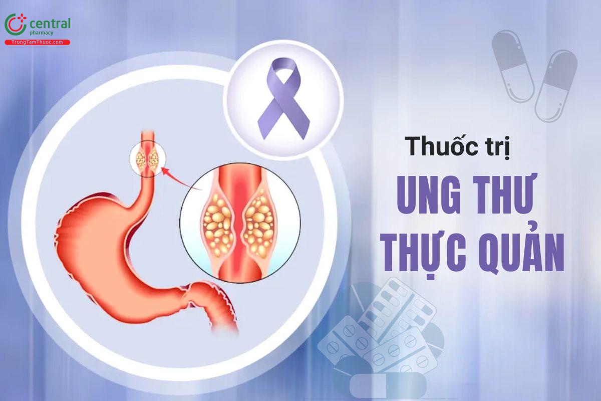 Phân loại các thuốc điều trị ung thư thực quản theo phác đồ chuẩn của Bộ Y tế