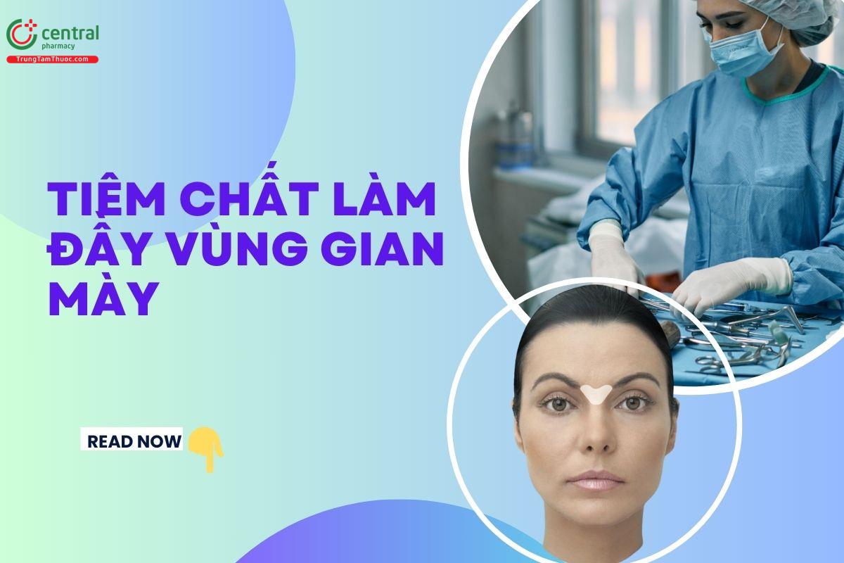 Tìm hiểu kỹ thuật tiêm chất làm đầy vùng gian mày