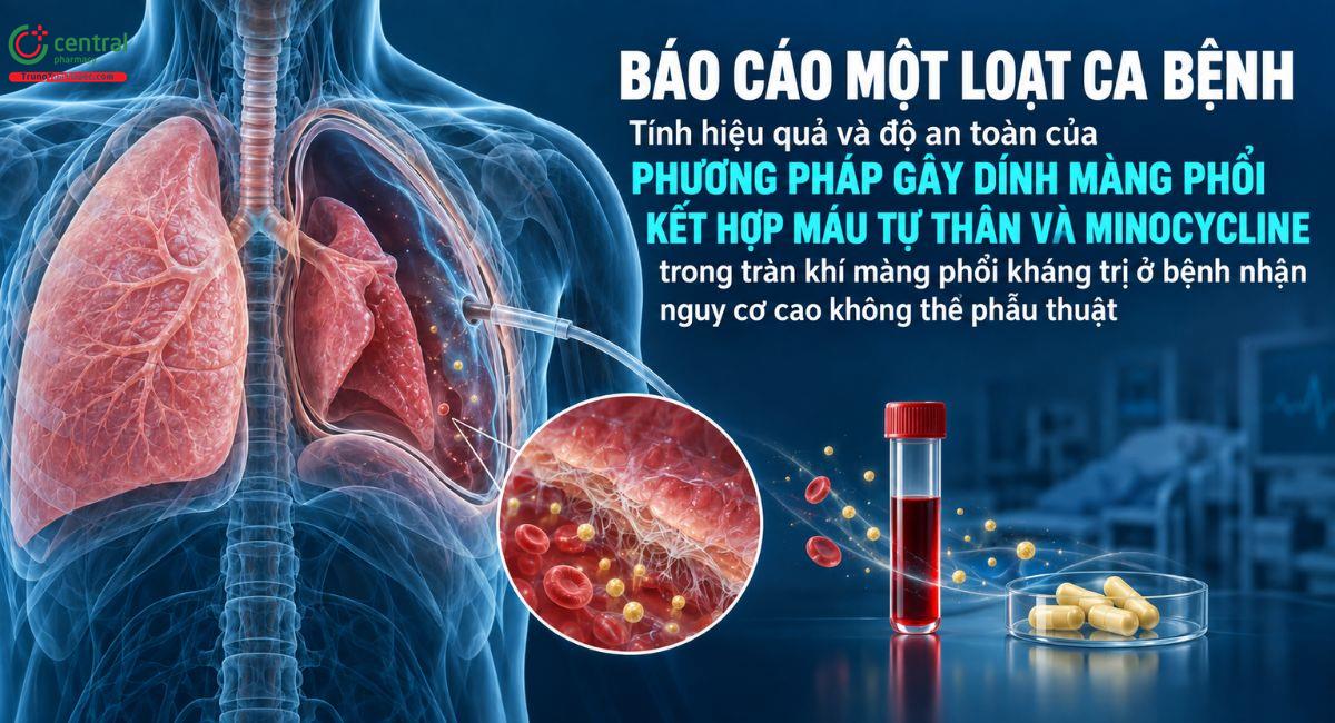 Tính hiệu quả và độ an toàn của phương pháp gây dính màng phổi kết hợp máu tự thân và minocycline trong tràn khí màng phổi kháng trị ở bệnh nhân nguy cơ cao không thể phẫu thuật: Báo cáo một loạt ca bệnh