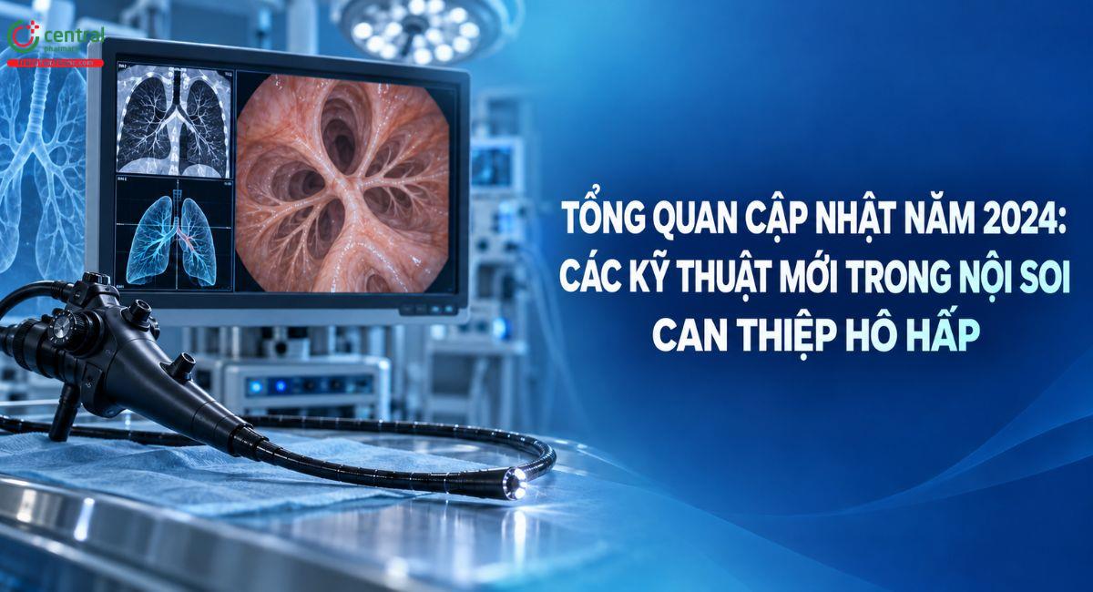 Tổng quan cập nhật năm 2024: Các kỹ thuật mới trong nội soi can thiệp hô hấp
