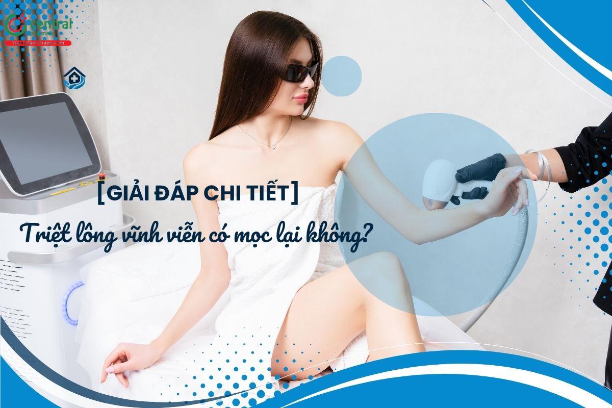 [Giải đáp chi tiết] Triệt lông vĩnh viễn có mọc lại không?