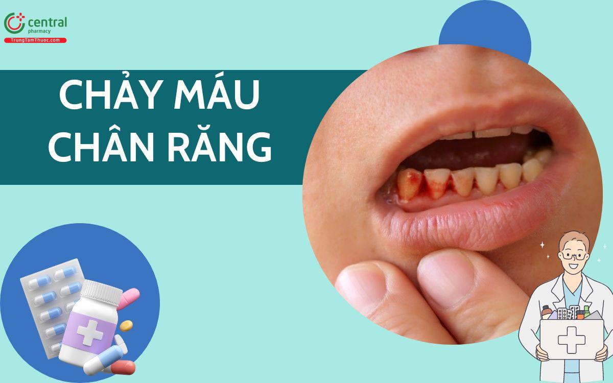 Tự nhiên chảy máu chân răng có phải cảnh báo ung thư? Cách điều trị dứt ...