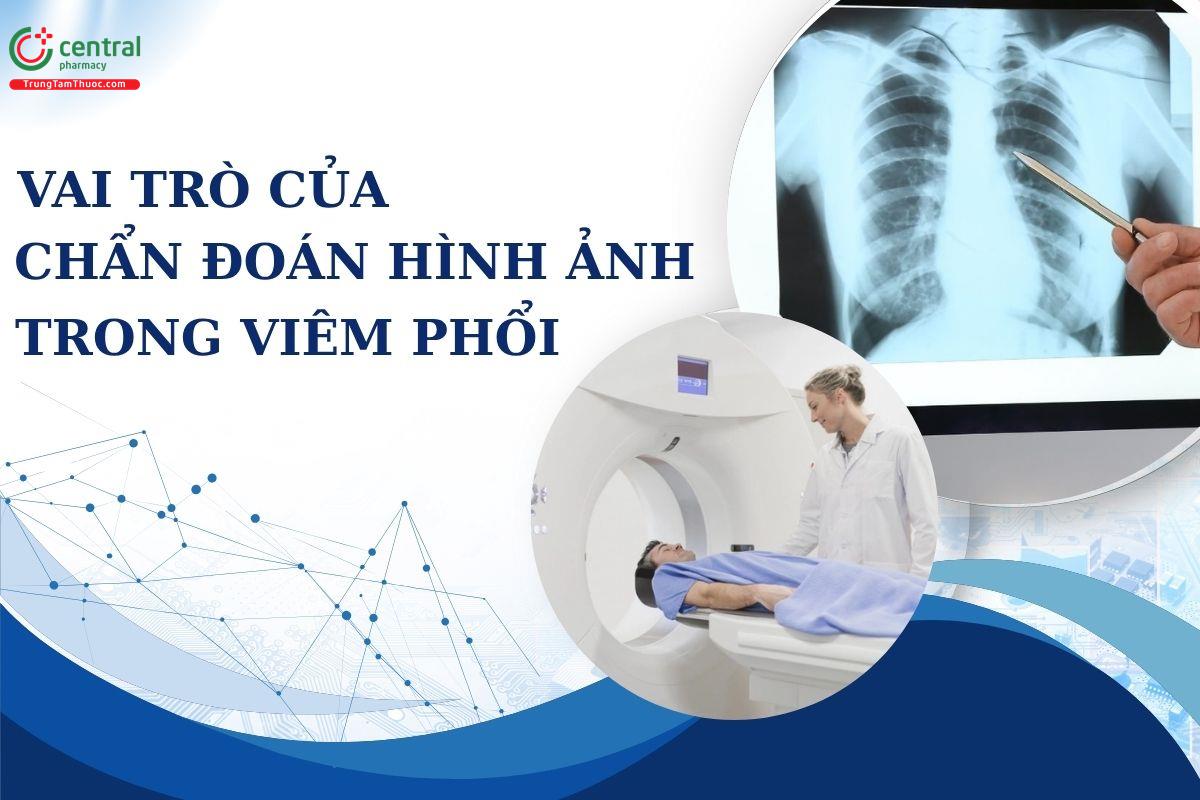 Vai trò của chẩn đoán hình ảnh trong viêm phổi