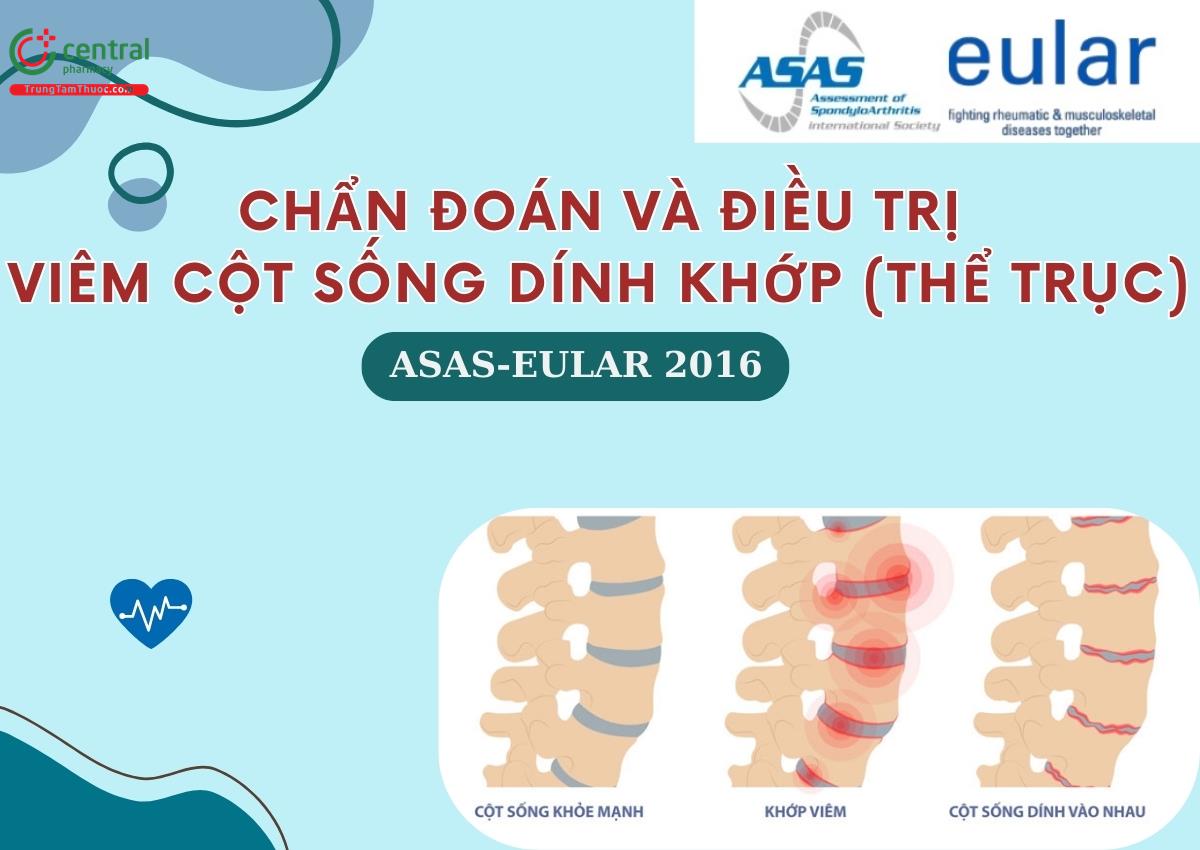 Chẩn đoán và điều trị viêm cột sống dính khớp (thể trục) - ASAS-EULAR 2016  