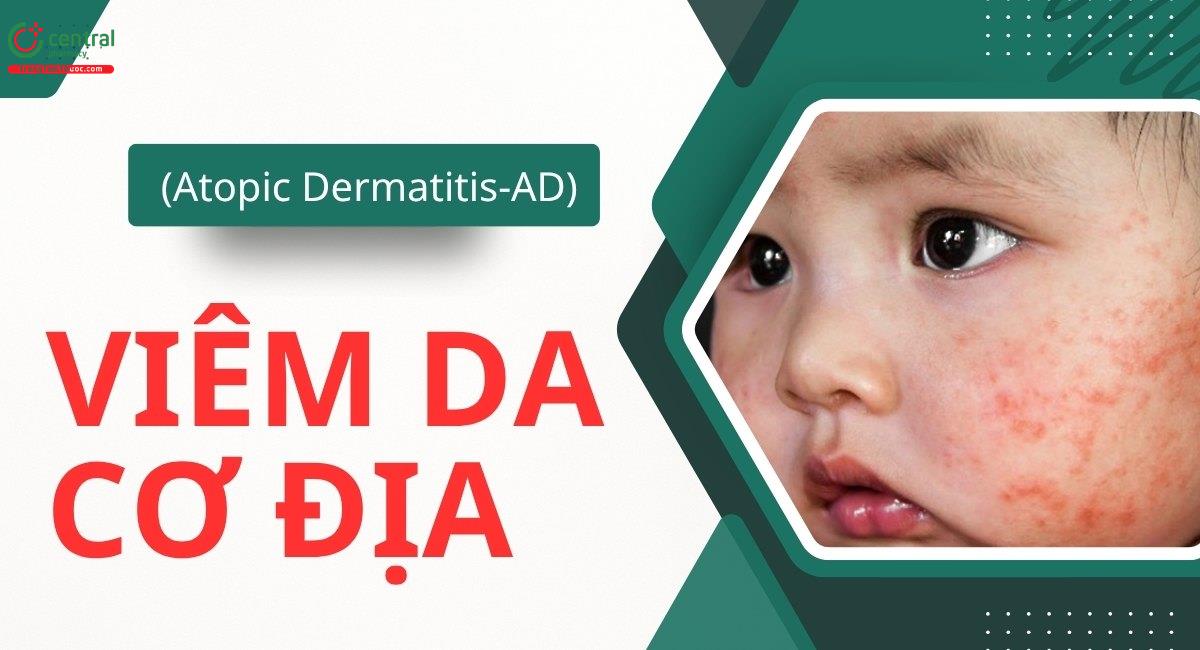 Viêm da cơ địa: nguyên nhân, cách điều trị, có lây không?