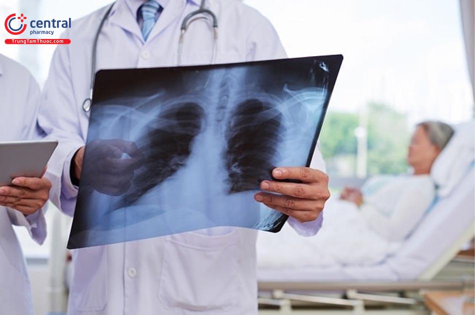 Viêm phổi bệnh viện: nguyên nhân, triệu chứng và cách điều trị