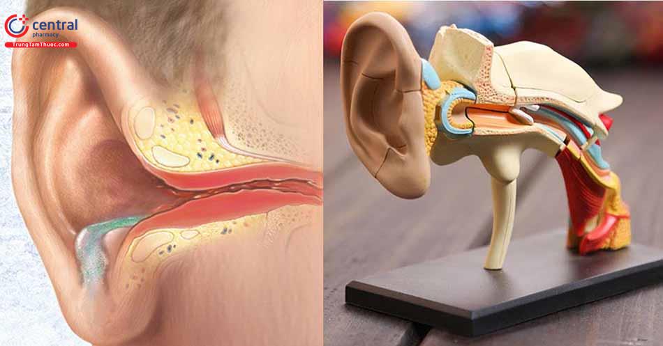 Viêm tai giữa mạn tính có cholesteatoma: nguyên nhân và điều trị