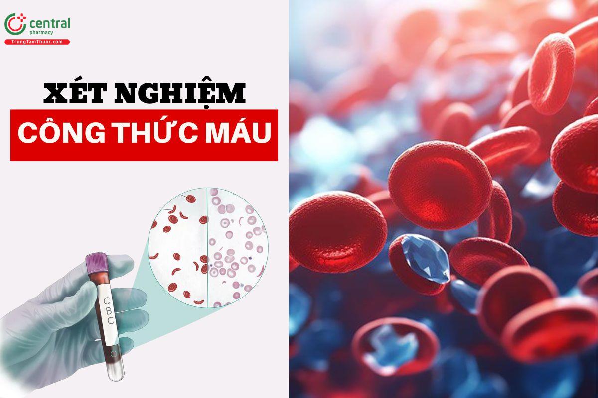 Xét nghiệm công thức máu biết được bệnh gì? Cách đọc kết quả xét nghiệm máu