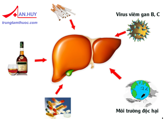 Nguyên nhân, cách phòng ngừa và chế độ chăm sóc bệnh nhân xơ gan