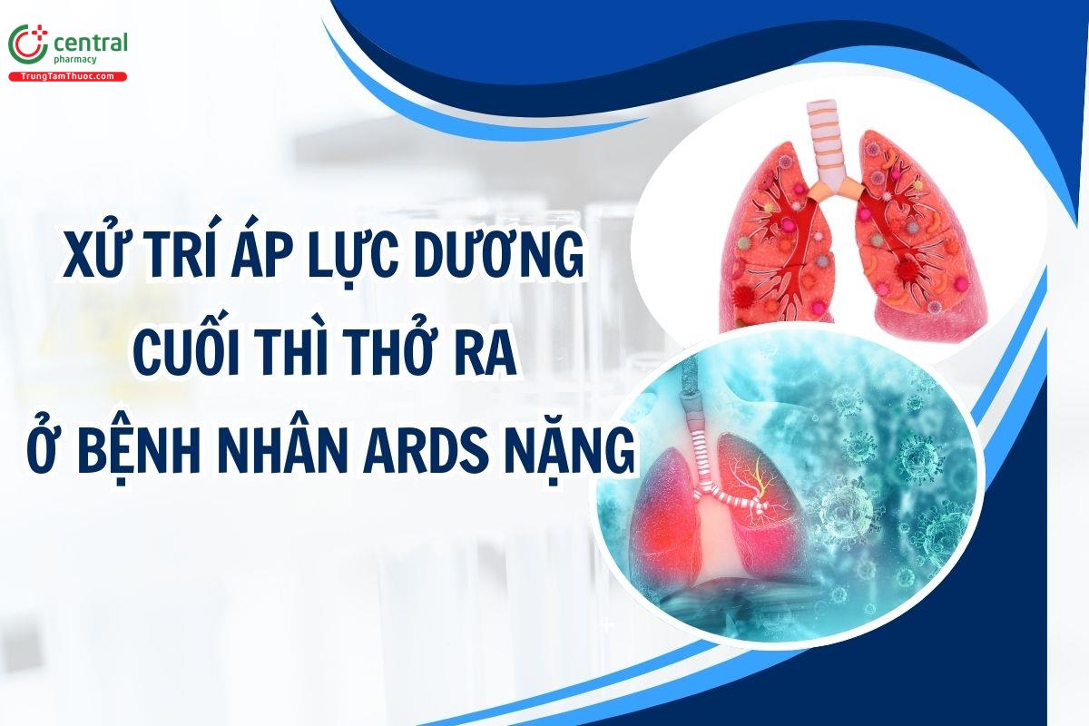 Xử trí áp lực dương cuối thì thở ra ở bệnh nhân ARDS nặng