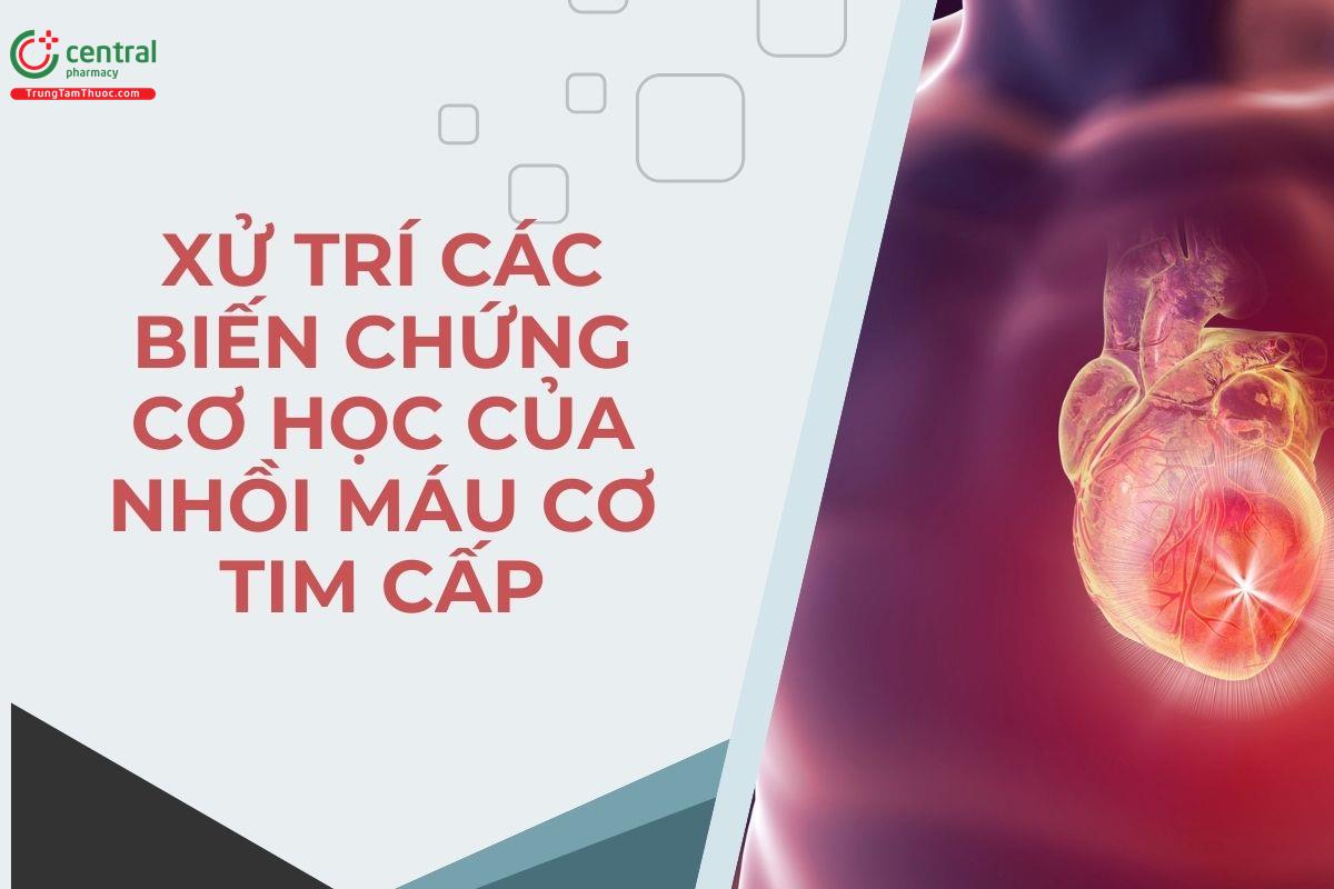 Xử trí các biến chứng cơ học của nhồi máu cơ tim cấp