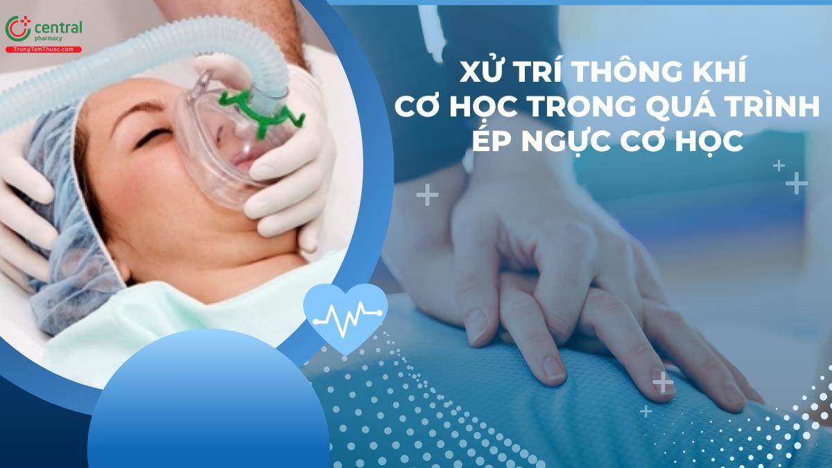 Xử trí thông khí cơ học trong quá trình ép ngực cơ học