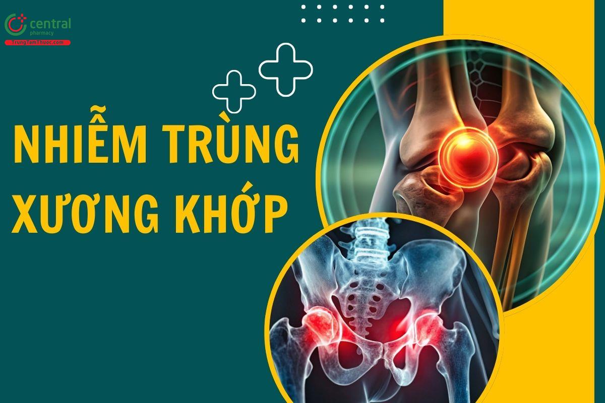 Nhiễm trùng xương khớp- Hướng dẫn của Bộ Y tế về định hướng chỉ định xét nghiệm vi sinh lâm sàng