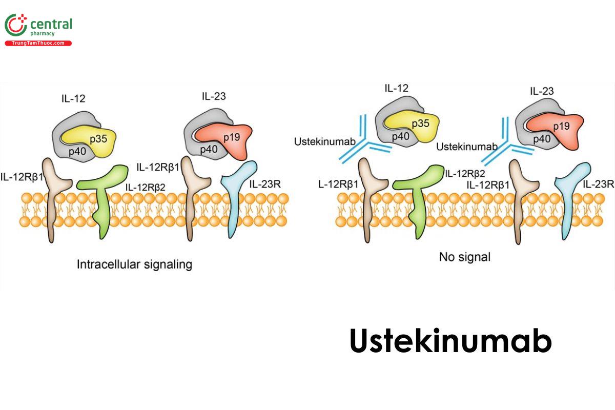 Ustekinumab