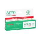 acnes blemish clear cream 2 K4164 130x130px