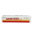 akneyash 1 J3478 130x130px