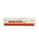 akneyash 2 U8282 130x130px