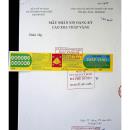 cao xoa thap vang 2 L4876 130x130px