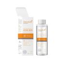 decumar makeup remover for acne skin 4 F2238 130x130px