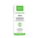 martiderm acniover serum 3 P6177 130x130px