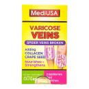 mediusa varicose veins 2 B0654 130x130px