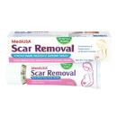 scar removal 2 G2820 130x130px