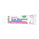 scar removal 4 B0360 130x130px