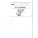 thuoc apiperin ex 5 125 mg 3 K4573 130x130px