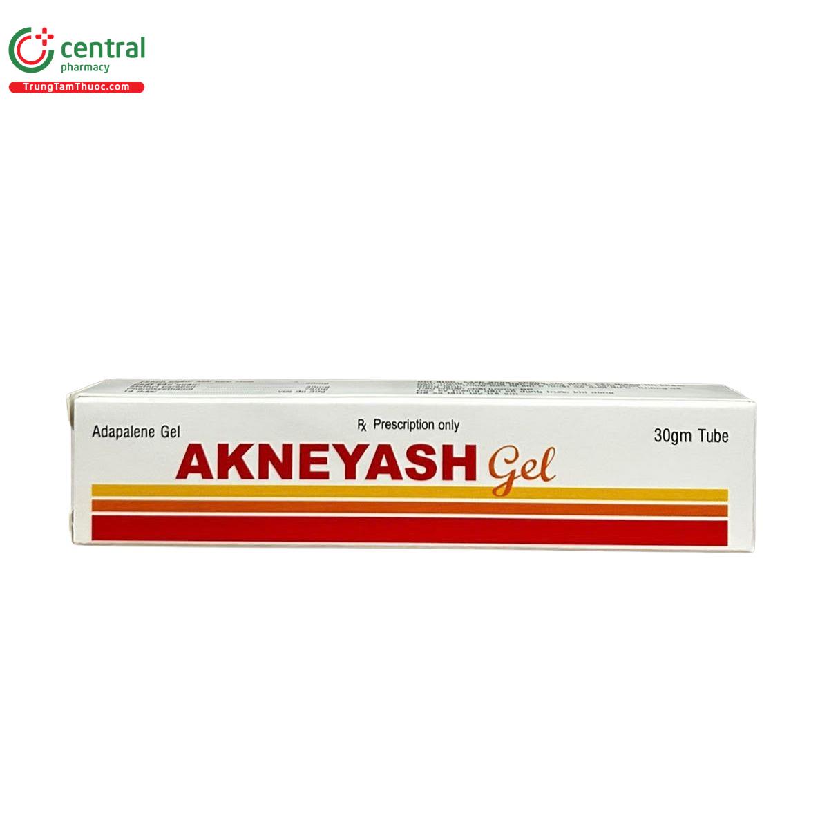 akneyash 2 U8282 akneyash 2 U8282