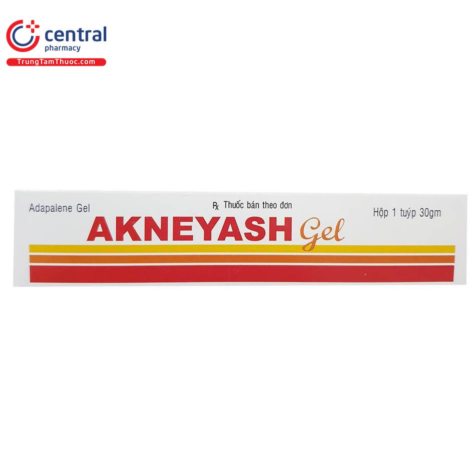 akneyash5 H3528