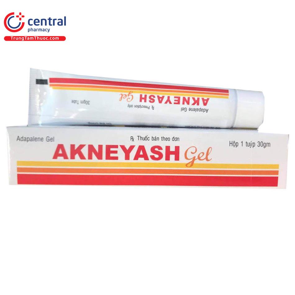 akneyash9 C0487