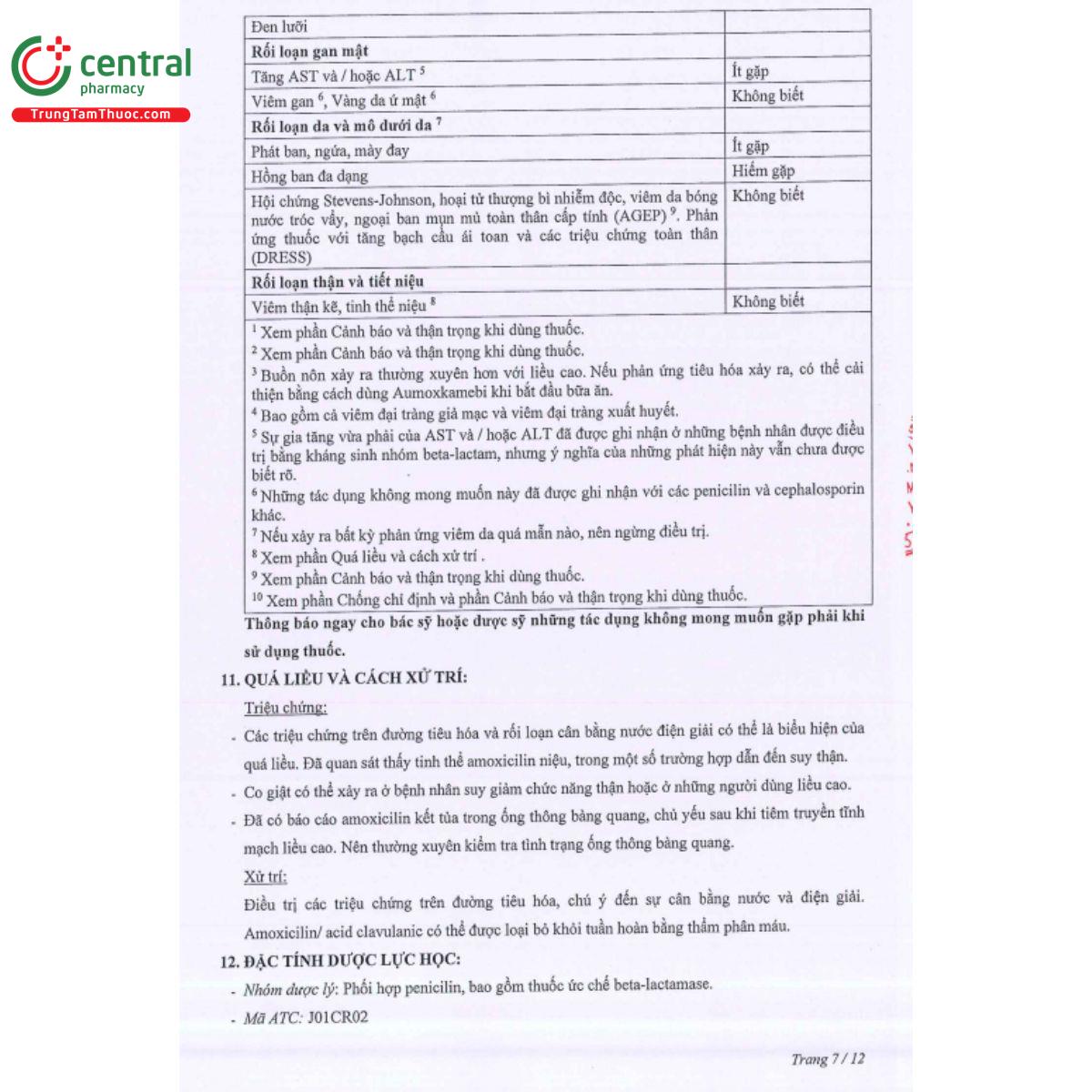 aumoxkamebi 1g 9 B0006