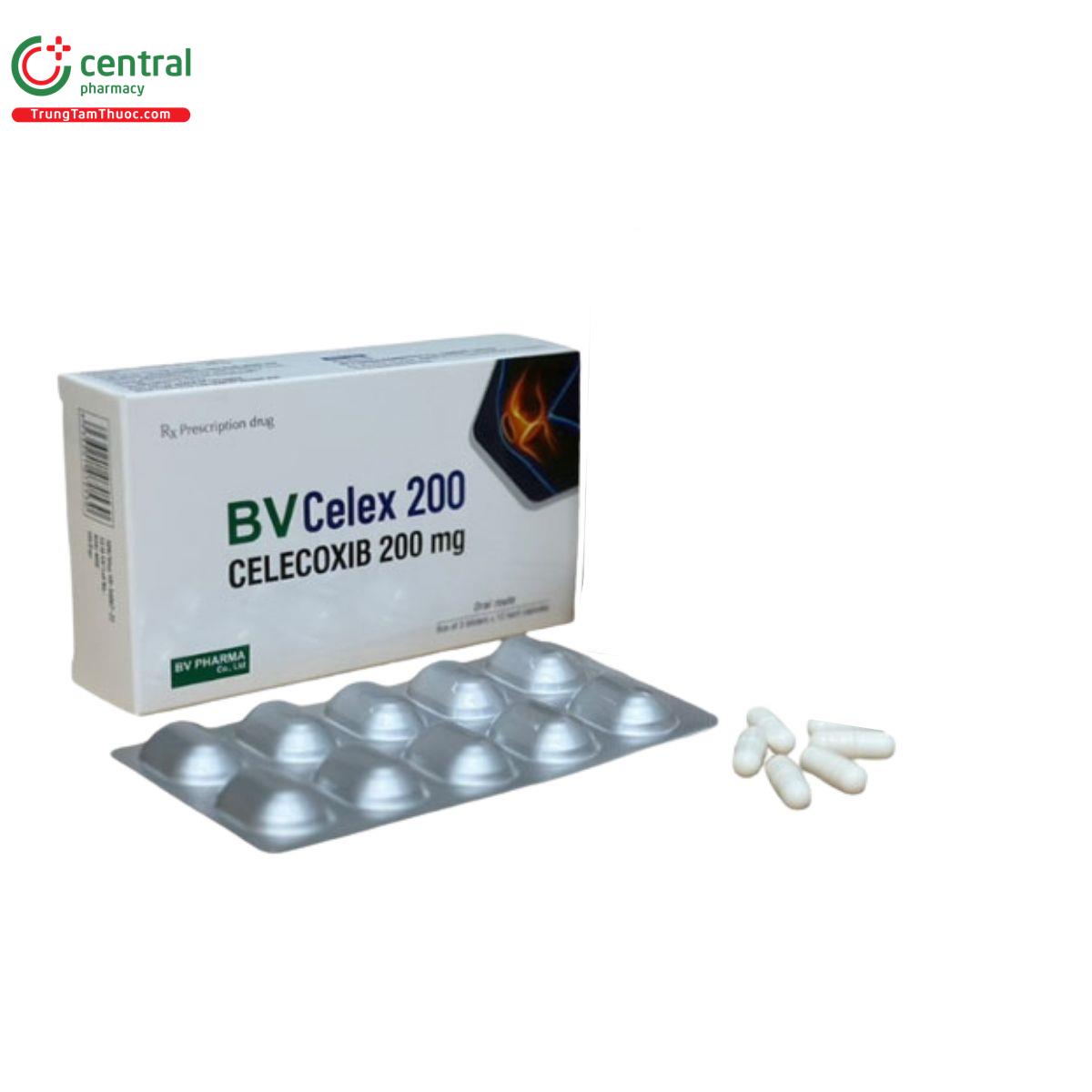 bv celex 200 5 J3756