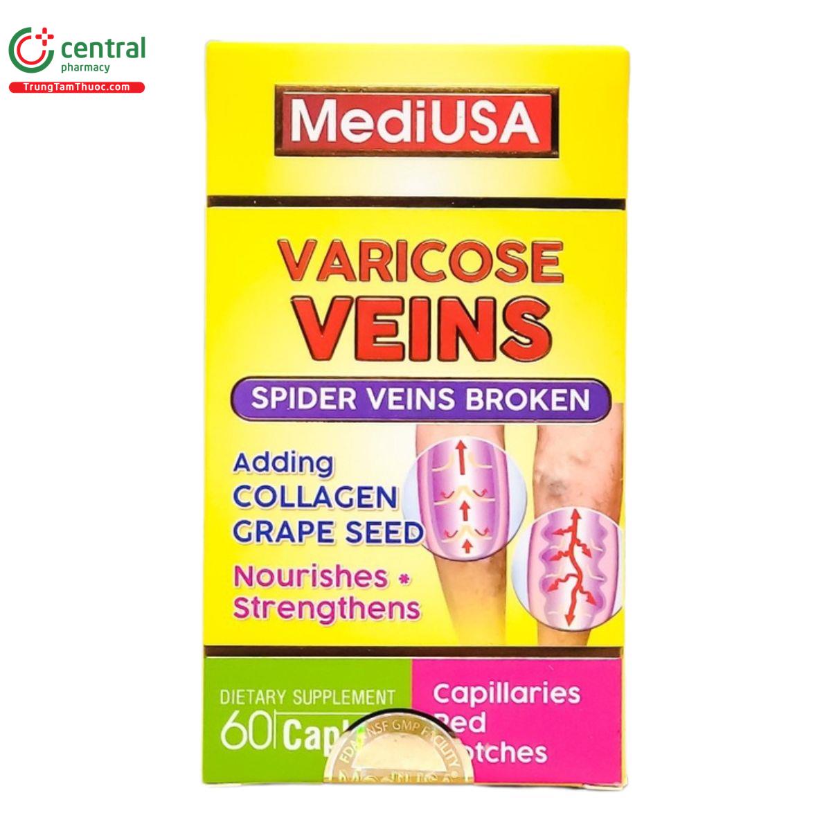 mediusa varicose veins 2 B0654