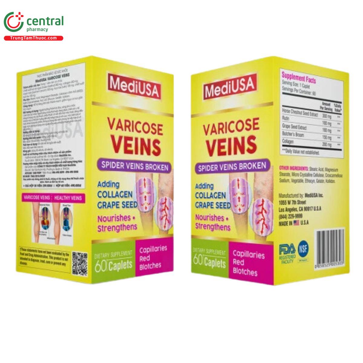 mediusa varicose veins 7 R7126