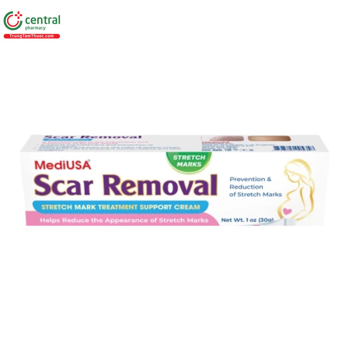 scar removal 3 J3018