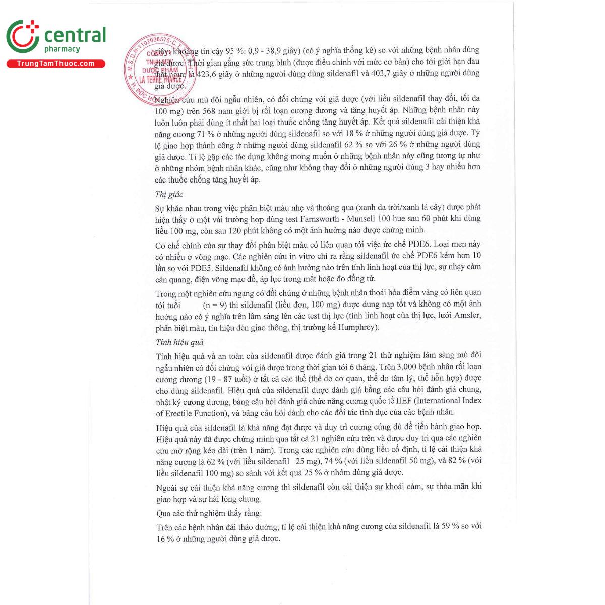 supergra 100 14 N5303